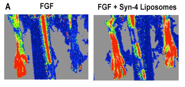 Laser doppler image of rat's leg prior to treatment (left) and seven days after injection of the coated FGF-2 (right)