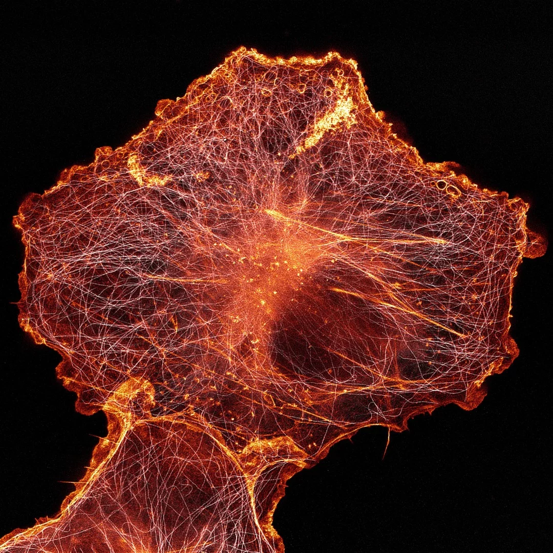 14th Place, African green monkey cell (COS-7) stained for actin and microtubules