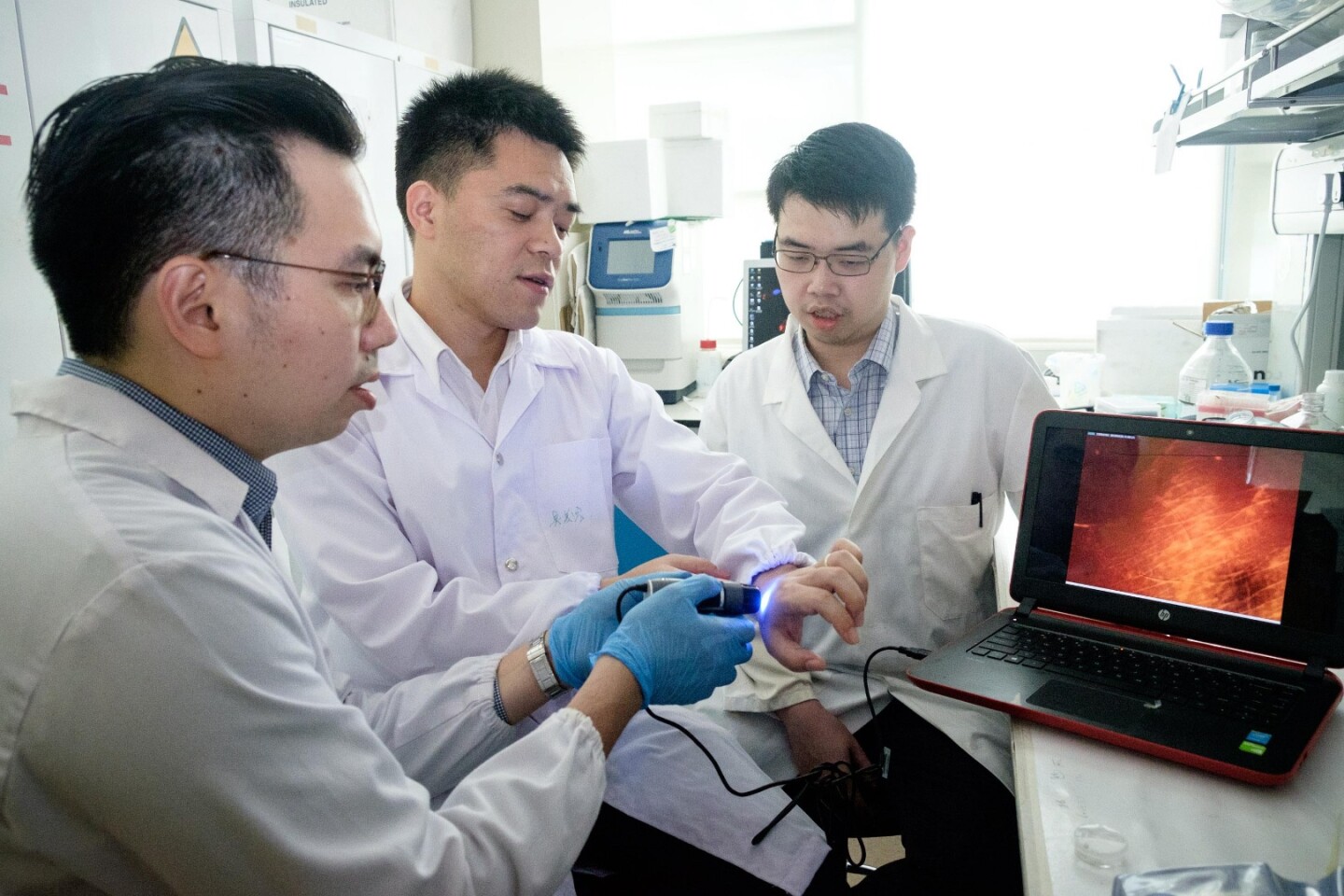 (From left) Dr. David Yeo, Asst Prof Xu Chenjie and Dr. Christian Wiraja using the NanoFlares to detect scarring