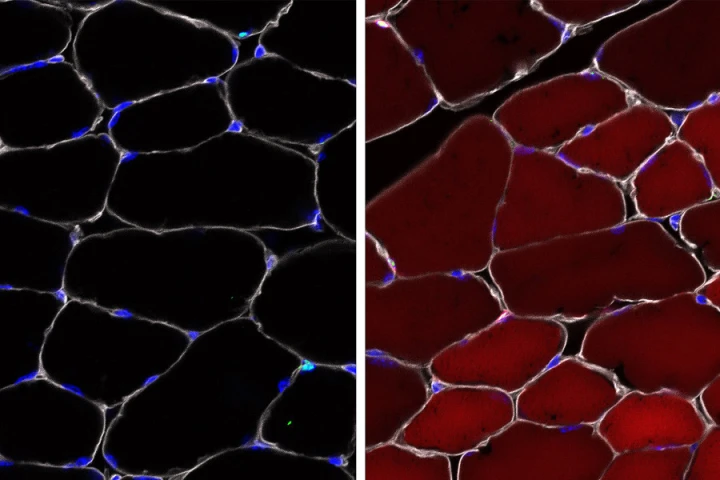 Left: the "reporter" cells before the gene-editing machinery is injected. Right: after the injection, the cells fluoresce red to indicate that the treatment worked