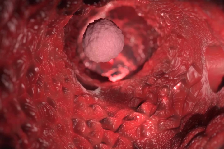 The new understanding of metastasis could lead to the development of improved therapies that help slow or even prevent the spread of tumors