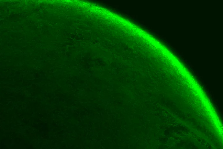 This image shows the distribution of chitosan over a mucin drop in flourescence