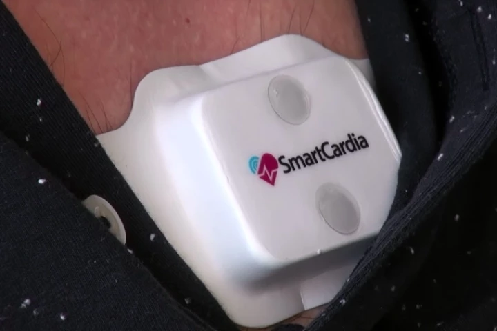 The Smartcardia patch has been approved for use in the European Union