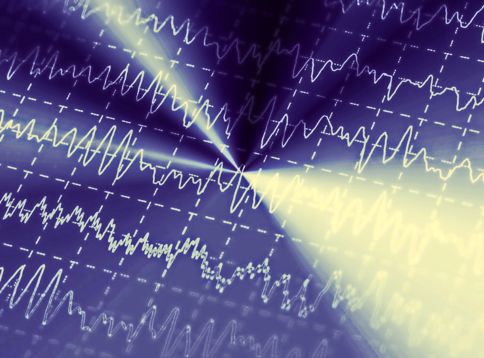 Prior to a new study scientists were unable to differentiate dreaming from waking states using EEG data alone