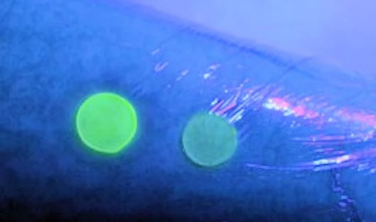 The new infection-indicating dressing on a healthy skin sample (R) and on an infected skin sample (L). The dressing in contact with infected skin glows under UV light