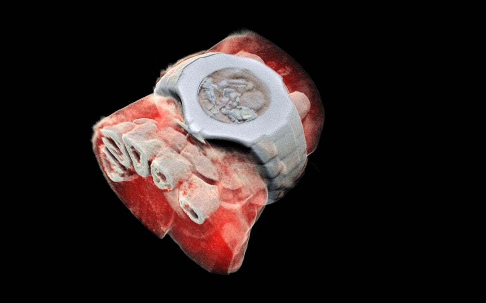Using CERN technology, Mars Bioimaging has created the first 3D, color X-ray images of the human body