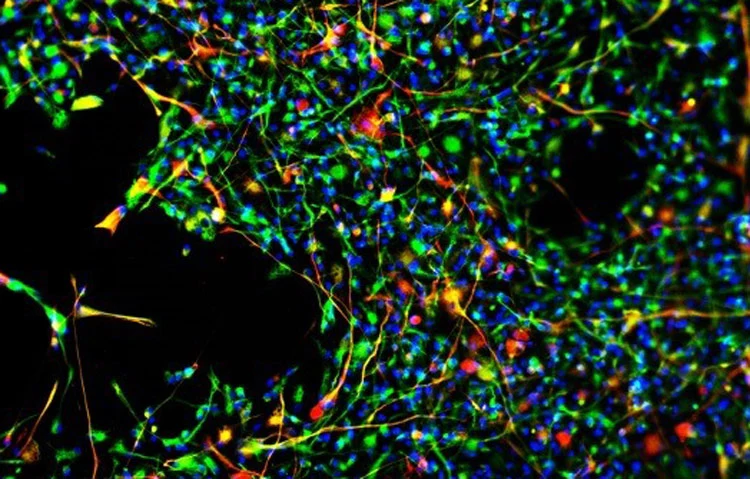 Neural stem cells maturing into brain cells in mice