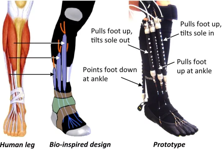 A diagram of the experimental orthotic device