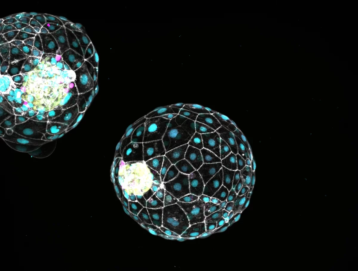 Dormant human blastoids, which could be the first step towards new fertility technologies