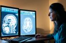 Rashi Mehta led a research team at West Virginia University investigating targeted ultrasound as a potential treatment for Alzheimer's