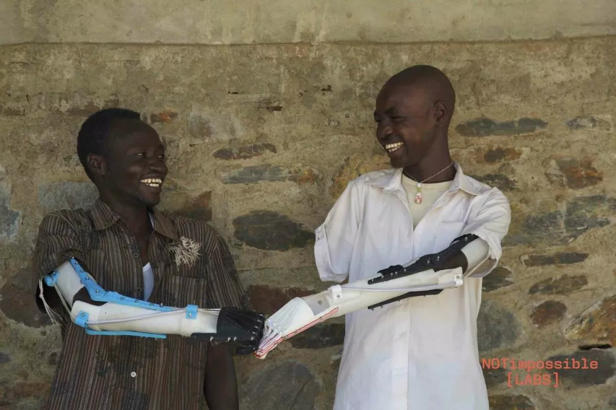 A team of experts from various fields were able to develop a prosthetic arm that could be made cheaply using 3D printing technology