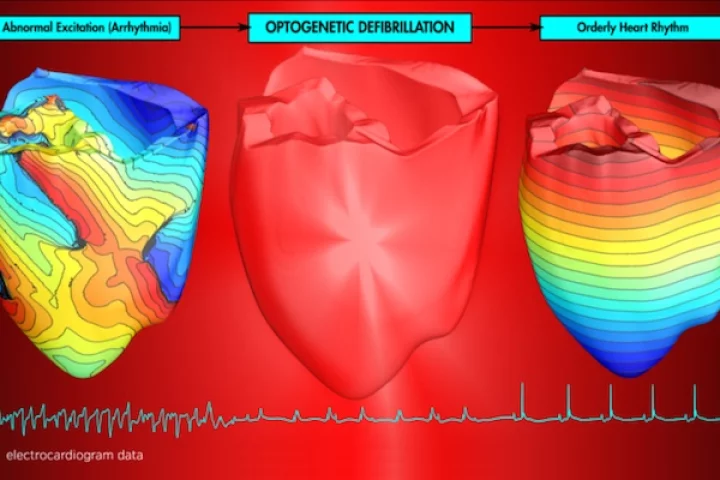 Scientists have found, in tests on mice and simulated human hearts, that administering painless pulses of light to correct irregular heart beats might be a viable alternative to harsh electric shocks