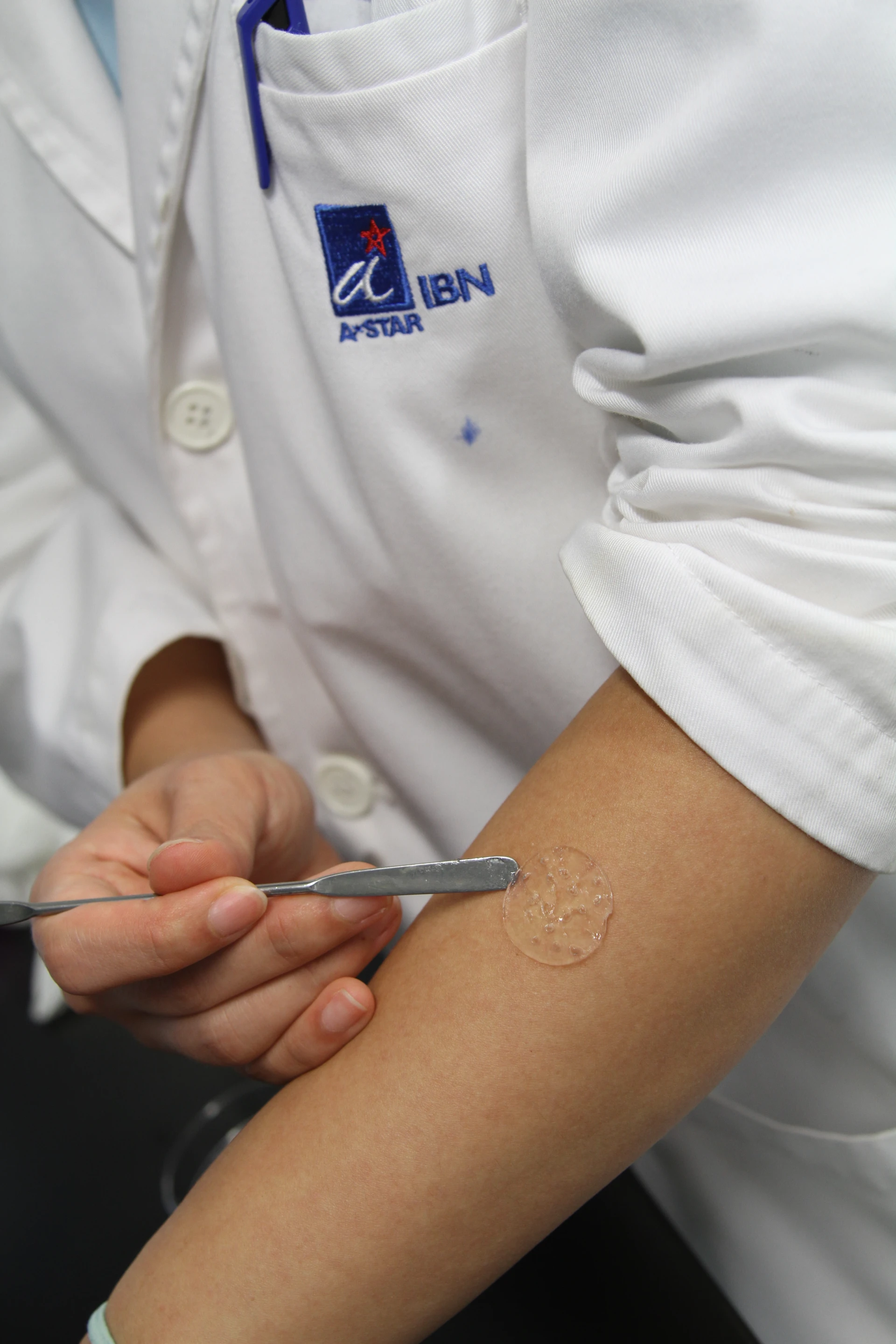 A nanogel developed at IBN may be commercialized as a membrane patch for faster healing of burn wounds (Photo:Institute of Bioengineering and Nanotechnology)