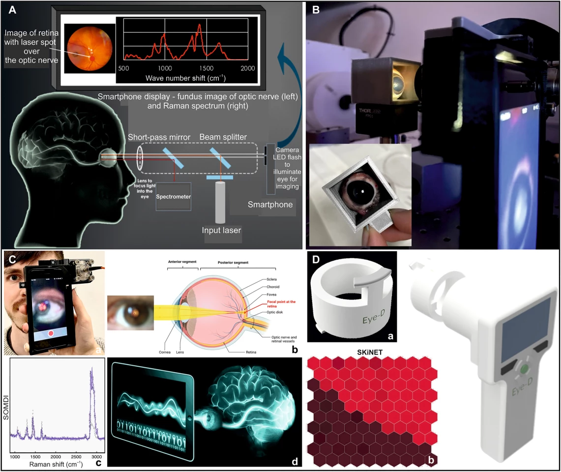 EyeD concept (A) and device use with a phantom eye (B). Lab prototype (C) and a mock-up of the handheld EyeD (D), which incorporates a disposable eye guard and SKiNET software for rapid, automated data classification and diagnosis