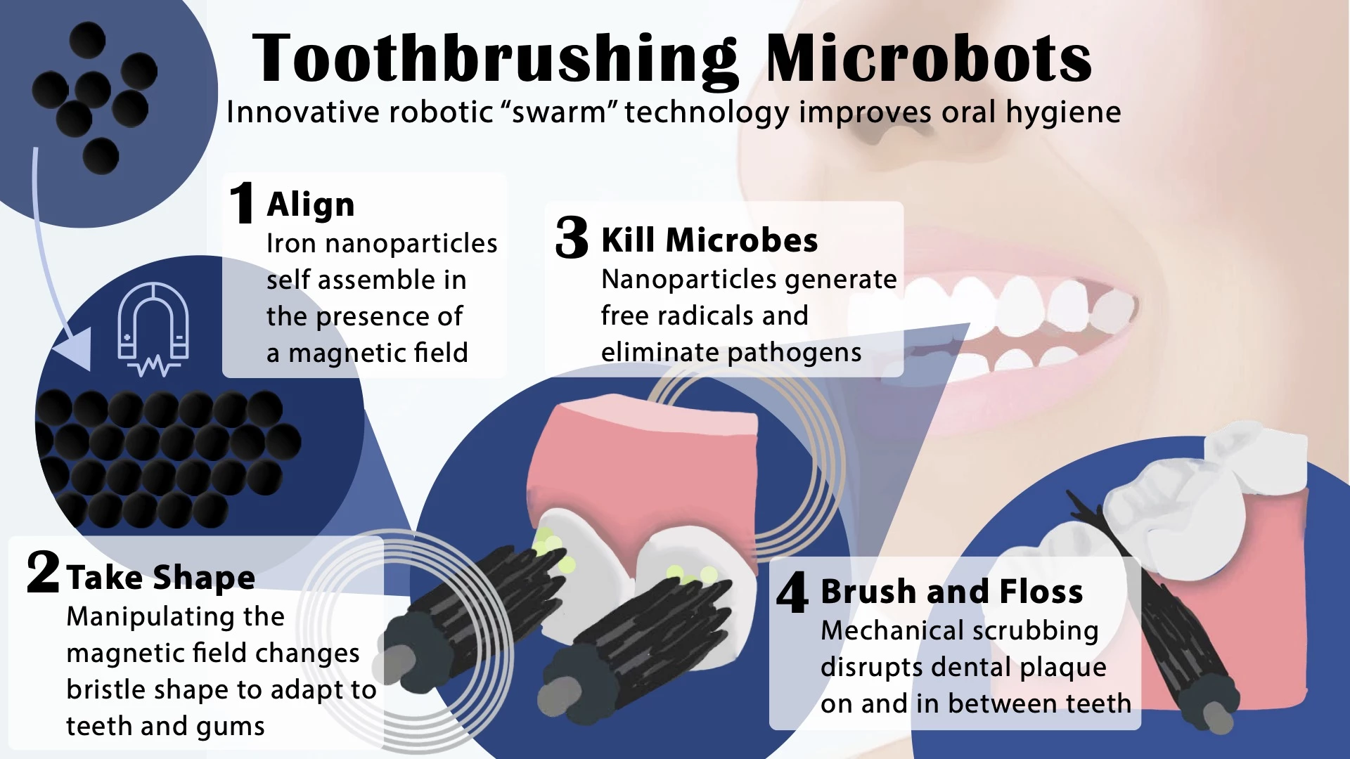 An infographic illustrating how the new microrobotic tooth-cleaning system works