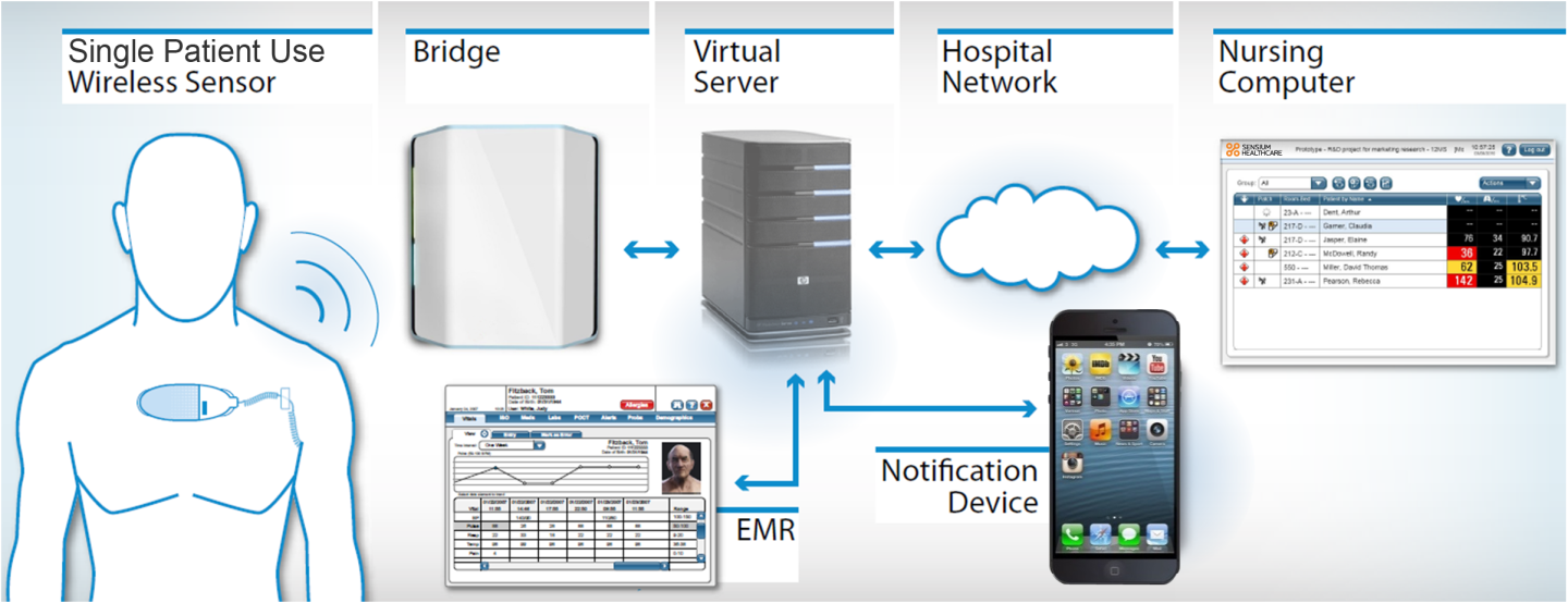 SensiumVitals pushes an alert to hospital staff computers immediately upon the detection of a deterioration in patient's vital signs (Image: Sensium Healthcare)