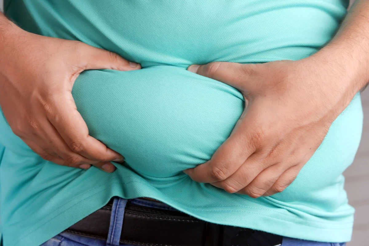 Where body fat is located, not the amount, may influence dementia risk