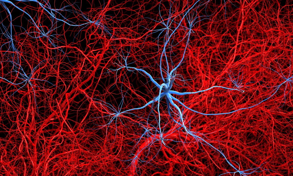 Alzheimer's impact on body fat explains its effects beyond the brain