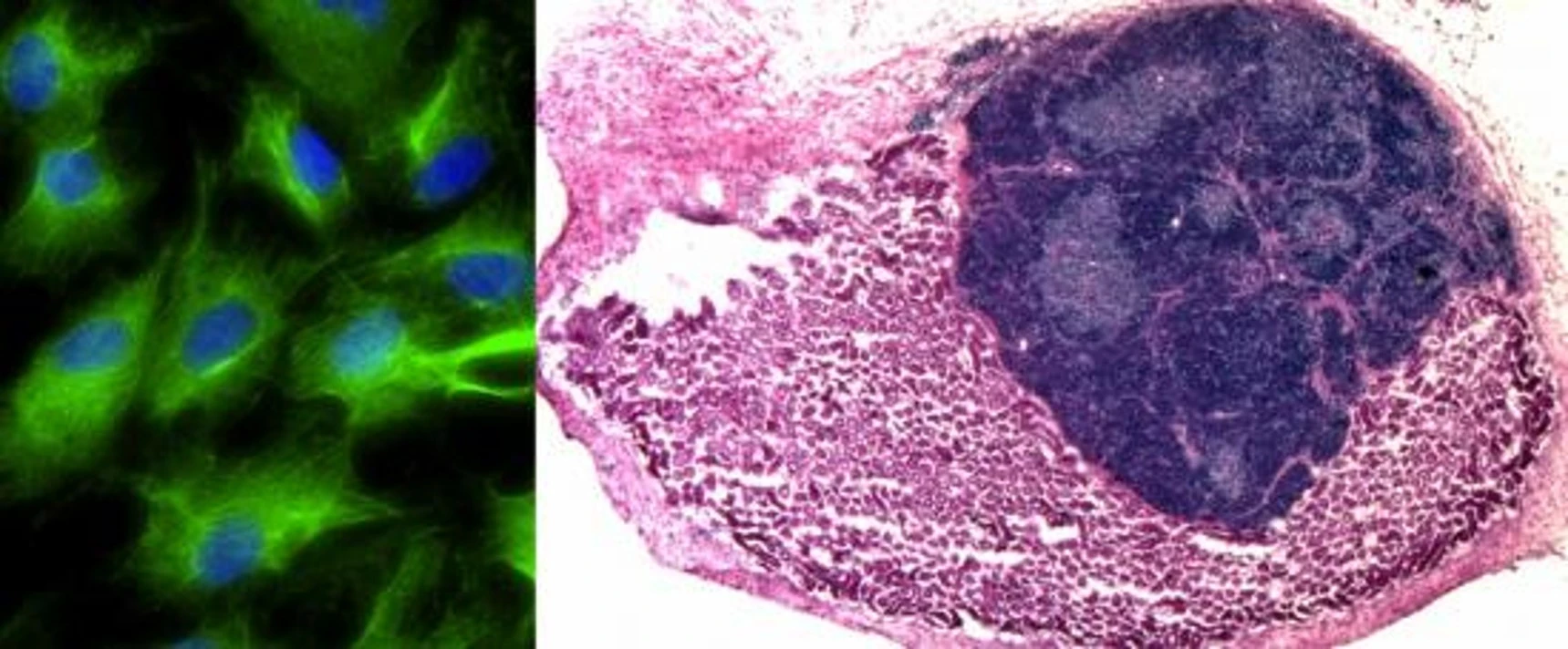 Fibroblasts transplanted onto the mouse kidney form an organised and functional mini-thymus (right, kidney cells in pink, thymus cells in dark blue) (Image: University of Edinburgh)