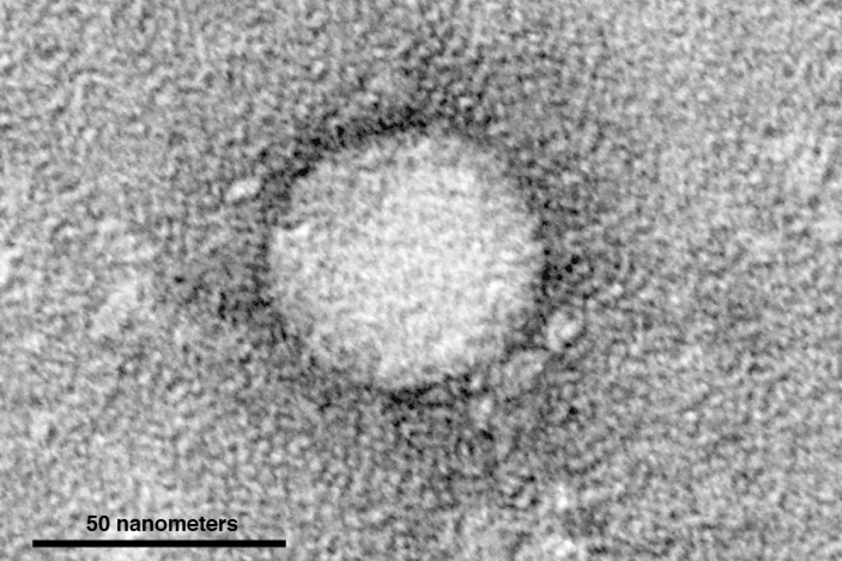 Electron micrographs of hepatitis C virus purified from cell culture