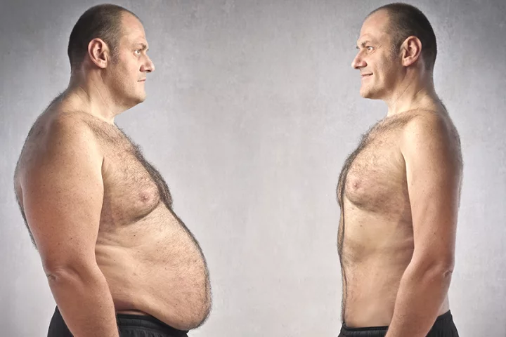 The identification of the mechanism that causes white fat cells to become brown fat cells could lead to new treatments for obesity and type-2 diabetes (Photo: Shutterstock)
