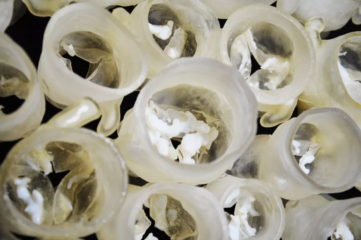 Scientists have used 3D printed models of individual heart valves and calcium buildup to help carve out the perfect fit ahead of surgery