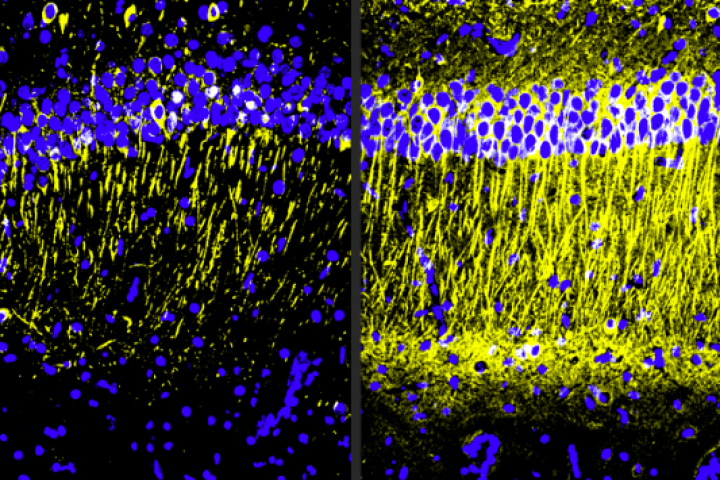 The brains of Alzheimer's model mice treated with A11 (right) showed more tubulin (yellow), a marker of neuronal health, compared to the untreated mice (left)