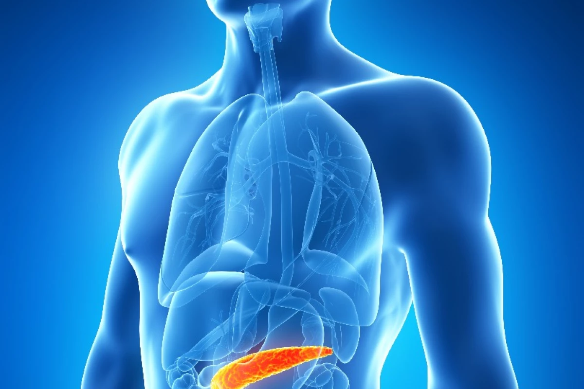 Reducing pancreatic fat can be highly effective in the treatment of diabetes