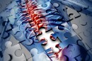 A new spinal stimulator implant could help restore motor function to paralyzed patients less invasively