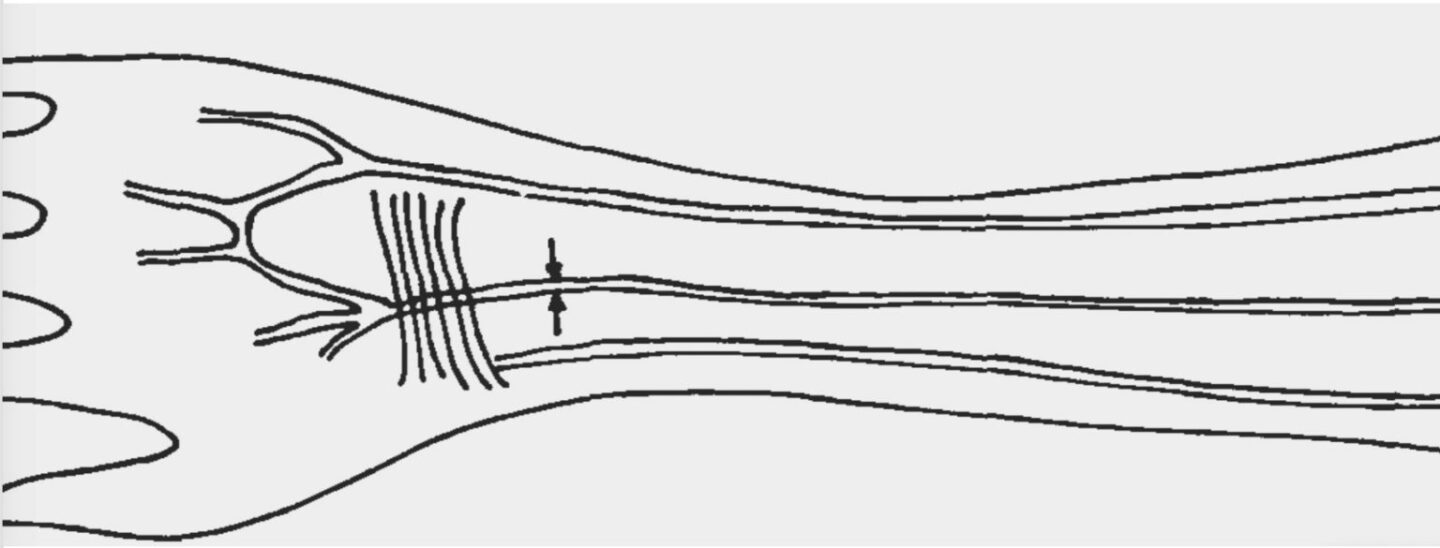 A sketch showing where the median artery can be found in a human forearm