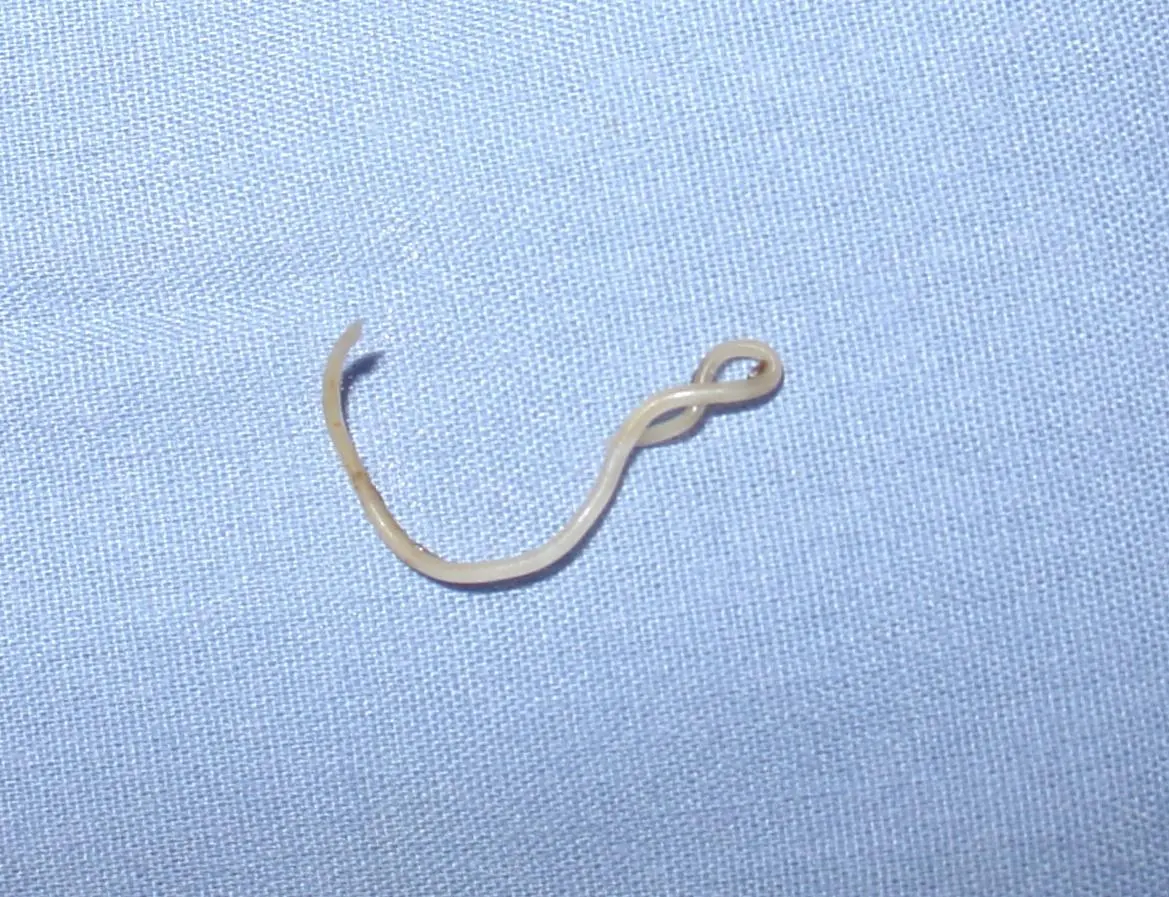 Scientists have mapped the genetic code of the T.canis roundworm, opening the door for new drugs, vaccines and diagnostic tests to be developed (Photo: University of Melbourne)
