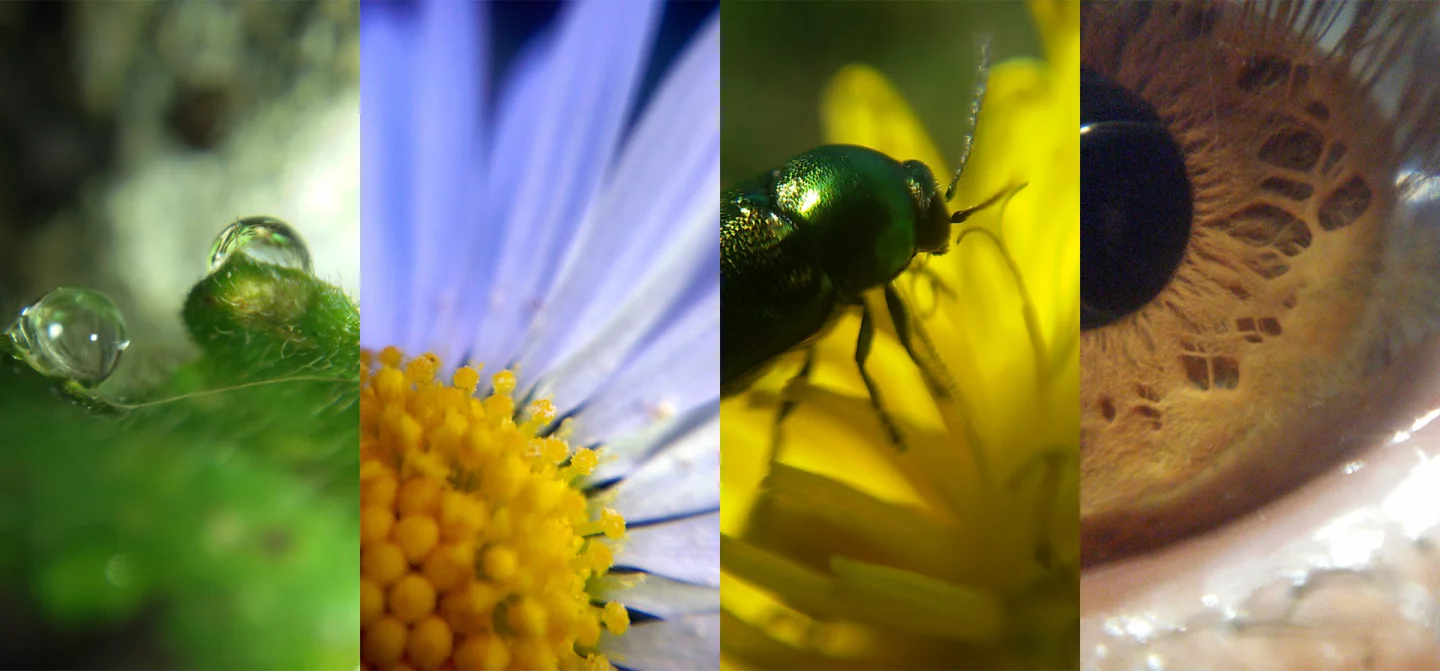 The Macro lens can be for observing things like bugs and insects or skin blemishes and abrasions