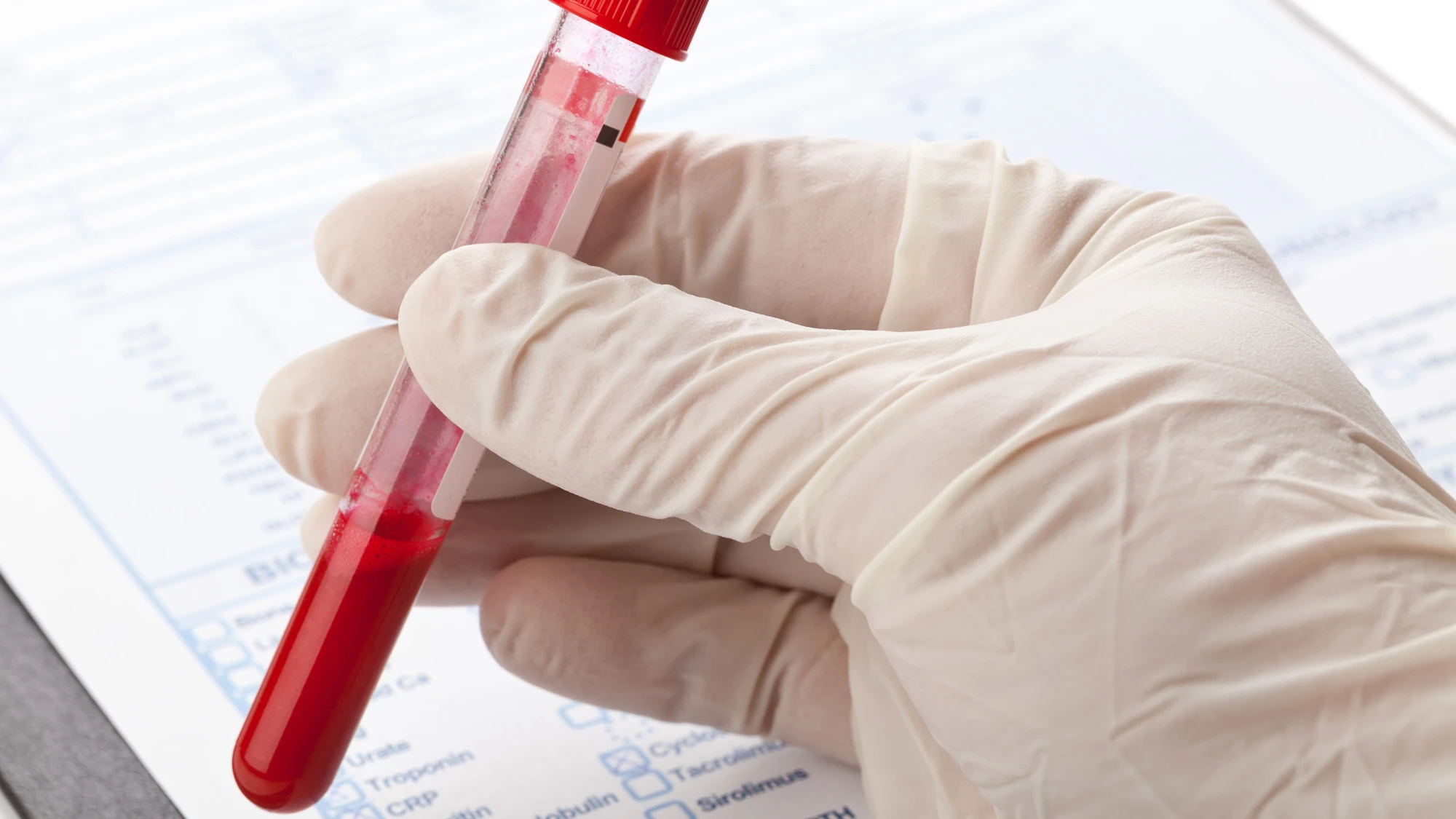 Research suggests a blood test to detect depression is possible (Photo: Shutterstock)