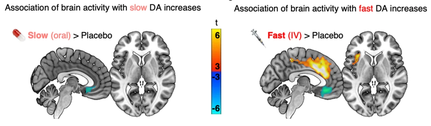 fMRI imaging showed that different routes of administration activated different brain regions