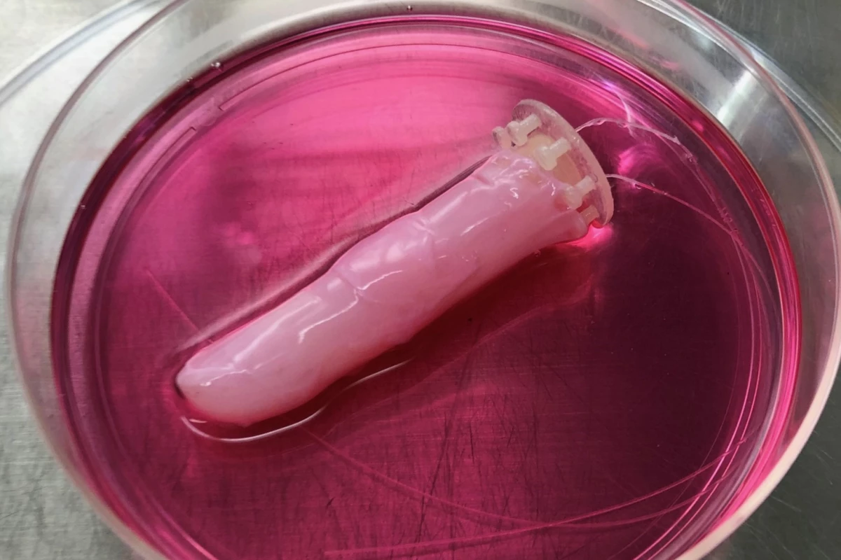 The three-jointed finger heals in a cell culture medium after its skin was intentionally cut