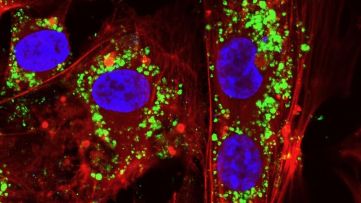 These ceramic particles, called nanoceria, mimic the biological behavior of enzymes from living organisms