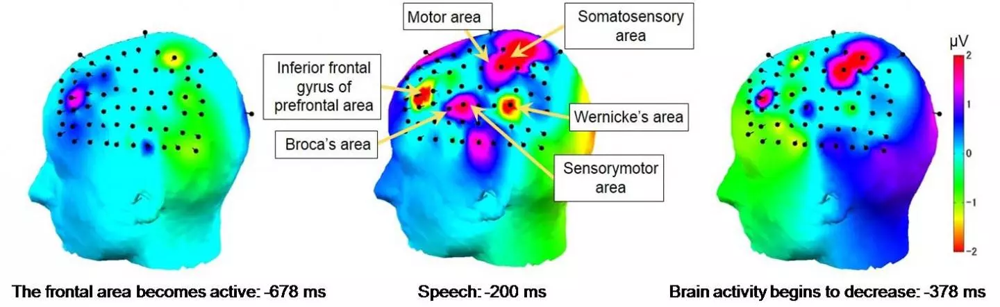 By using an electroencephalogram (EEG) cap to monitor brain activity, the system recognized 18 single-syllable Japanese words with 61 percent accuracy