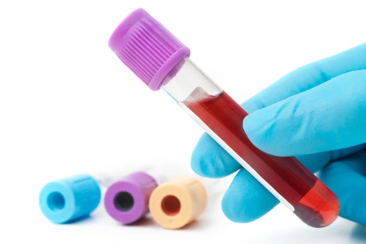 A new blood test detecting eight different types of cancer is proving promising in early clinical trials