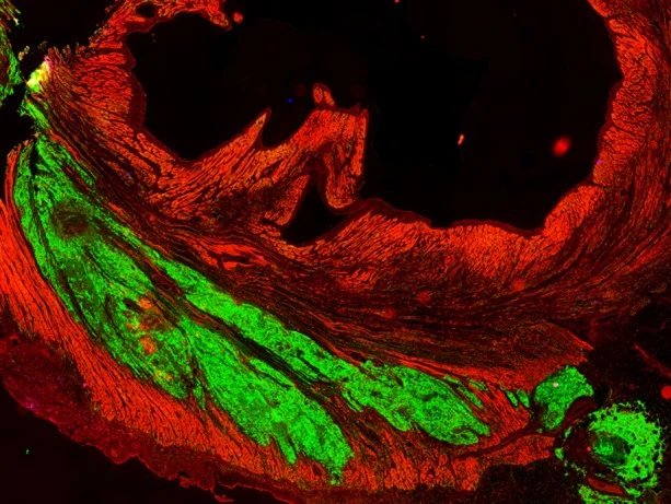 Three months after the injections, the cells appeared full integrated with the original tissue