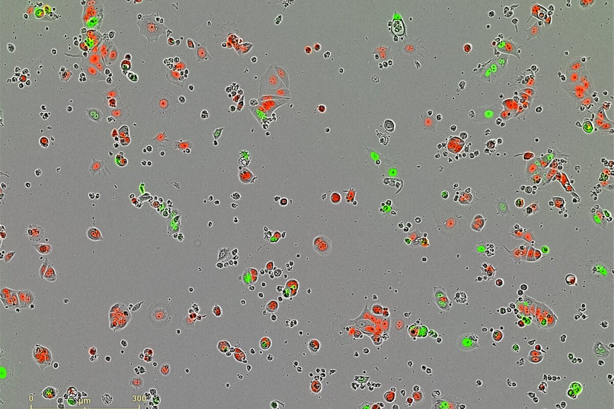 Current Treatments Send Breast Cancer Into Sleeper Mode current-treatments-send-breast-cancer-into-sleeper-mode
