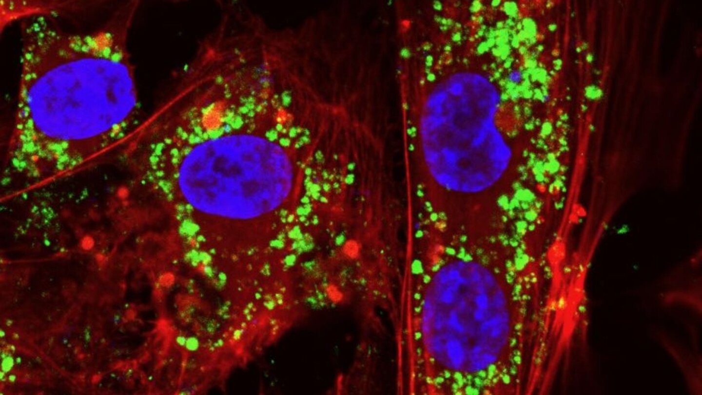 These ceramic particles, called nanoceria, mimic the biological behavior of enzymes from living organisms