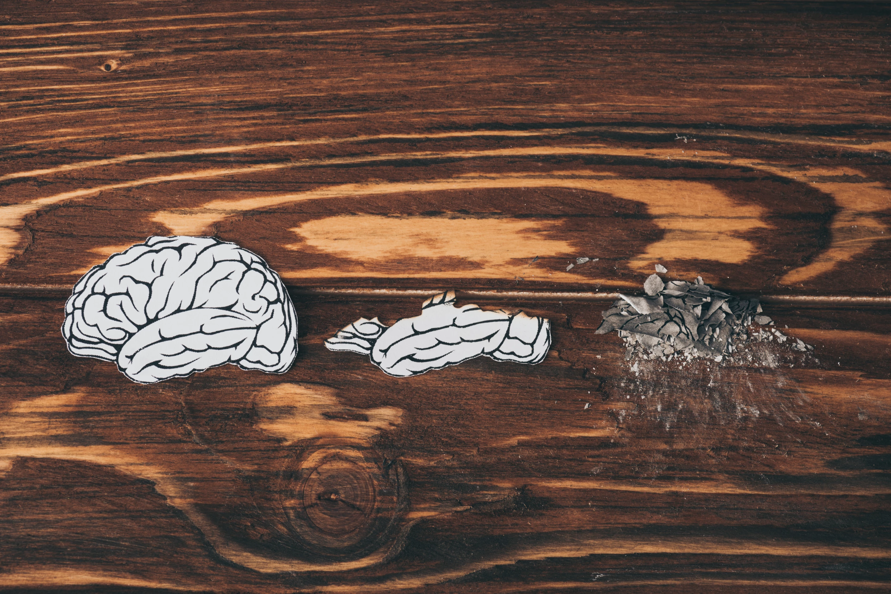 New research has found diabetics who go on to develop dementia display higher blood pressure for years before cognitive decline appears, compared to diabetics who don't develop dementia