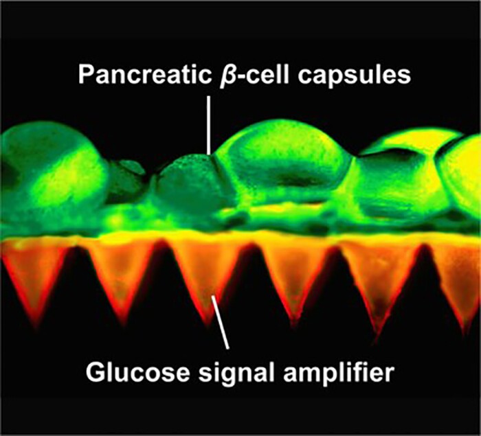 The researchers also created what they called glucose-signal amplifiers, synthetic nanovesicles filled with chemicals that enable them to recognize rising blood sugar levels and release insulin where needed