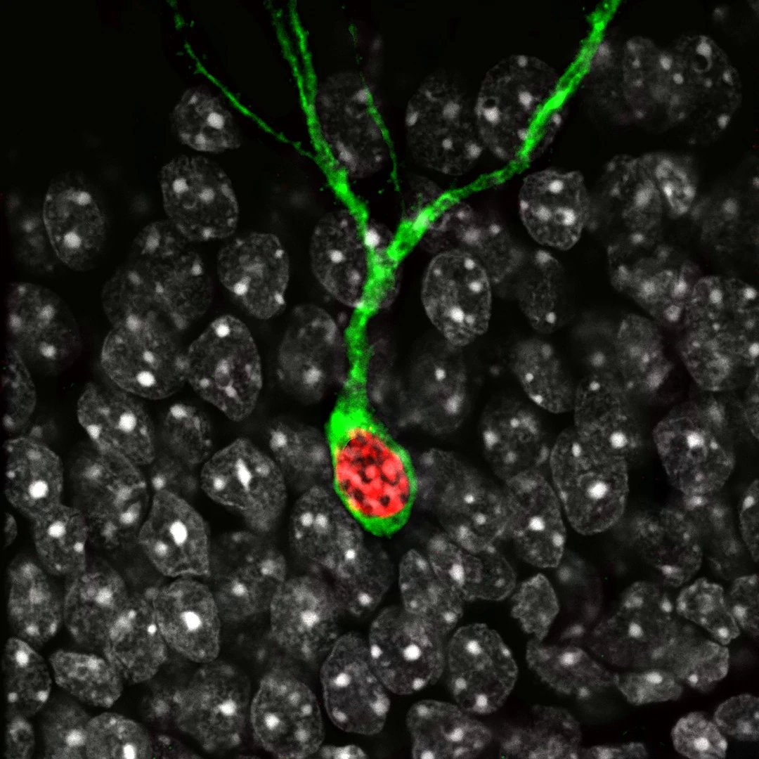 The green shows a cell active when recalling a traumatic memory, the red is a cell following trauma therapy. The study shows where in the brain traumatic memories can be specifically rewritten to eliminate negative responses