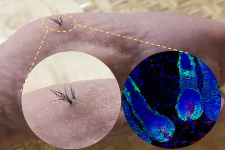 Scientists were able to generate new hair in bald mice that penetrated the skin