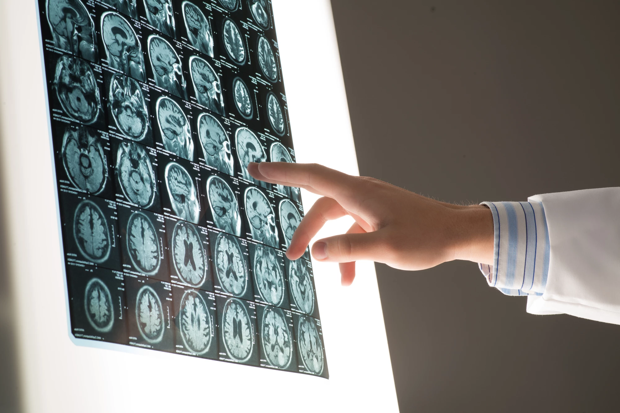 X-rays could reveal tumors at higher resolution than MRI