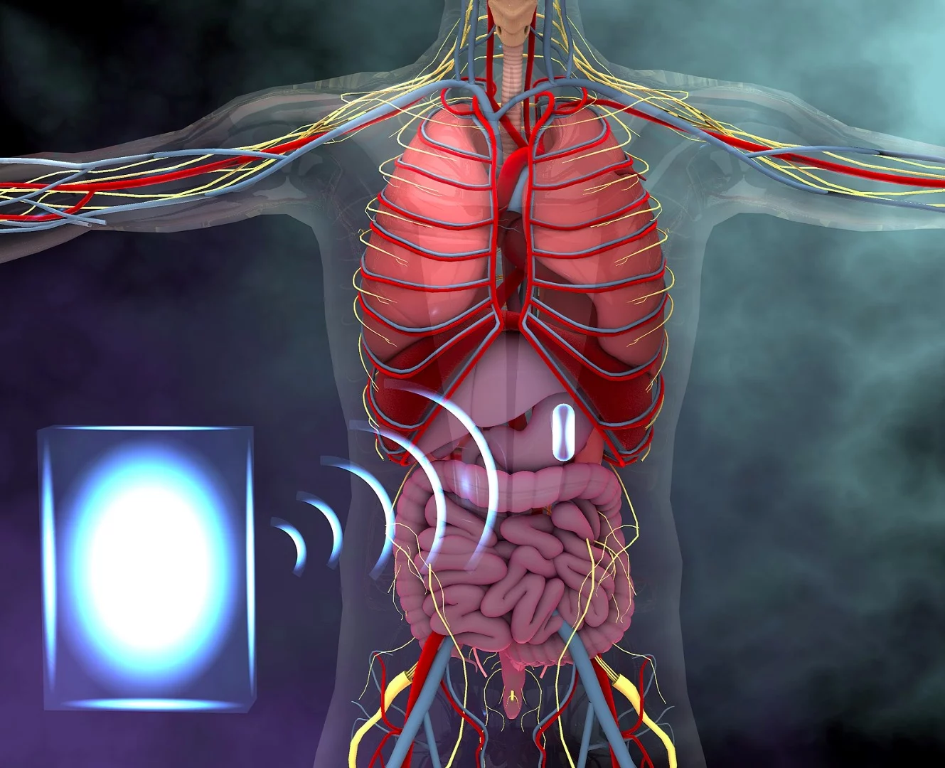 An illustration showing how an electronic device in the stomach could be powered wirelessly