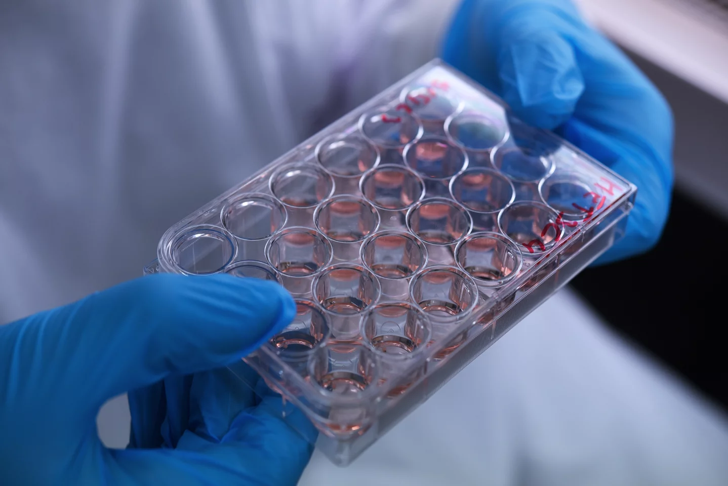 Human stem cell-derived brain organoids allow researchers to carry out experiments that would be ethically and practically difficult in human subjects