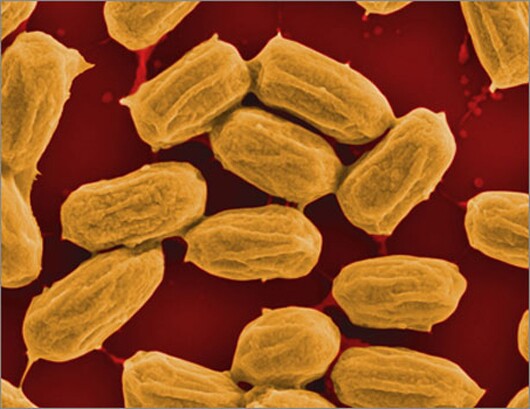 As Bacilli bacteria dry out and form spores (shown here), they wrinkle, and as they rehydrate, they swell (Photo: Xi Chen/Columbia University)