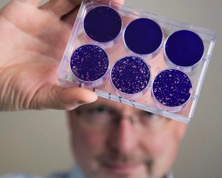 Dr. Matthias Grimier holding up a sample of the modified poliovirus that can attack and kill tumor cells